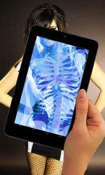 Xray Scanner screenshot 3