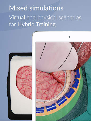 UpSurgeOn Neurosurgery screenshot 9