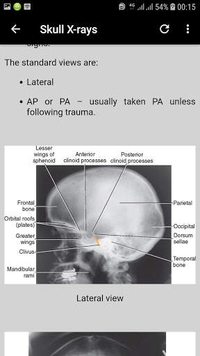 x-ray interpretation guide screenshot 6