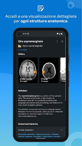 e-Anatomy screenshot 5