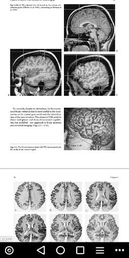 MRI - Regional Anatomy of the Brain Using MRI screenshot 4