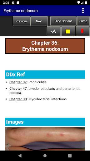 Pediatric Dermatology DDx Deck, 2nd Edition screenshot 4