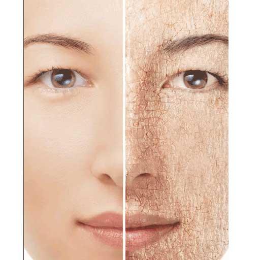 Dry Skin Causes and Solutions icon