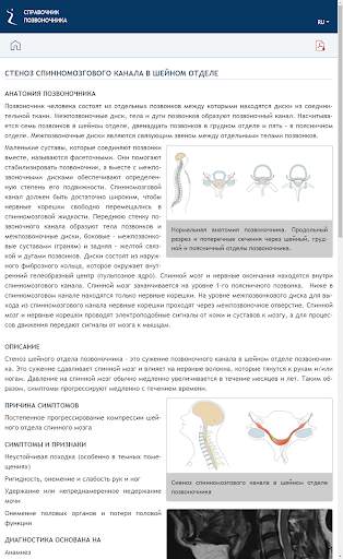 СПРАВОЧНИК ПОЗВОНОЧНИКА скриншот 3