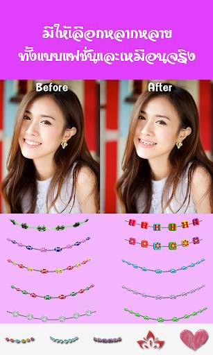 แต่งรูปดัดฟัน จัดฟันสวย screenshot 2