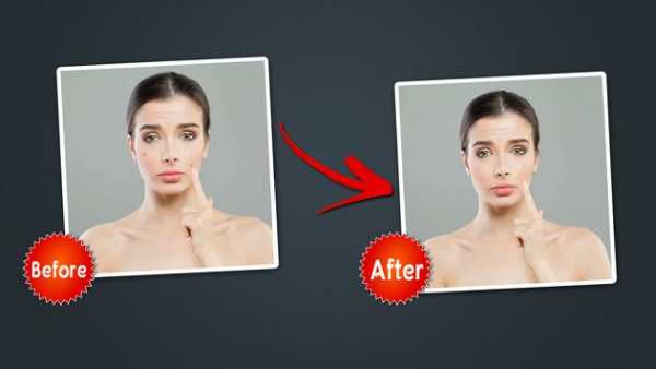 Object Remover -Erase Object -Face Blemish Remover screenshot 14
