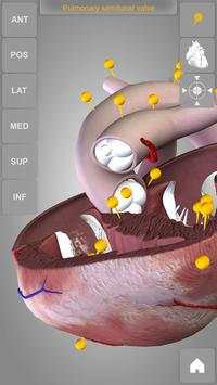 Heart 3D Anatomy Lite screenshot 16