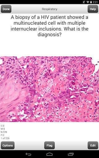 USMLE Step 2 CK Cards Lite screenshot 8