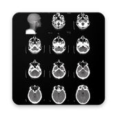Normal Findings in CT and MRI Brain icon