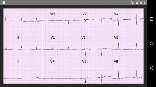 ECG 100 Clinical Cases screenshot 2
