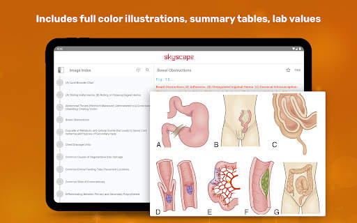 Medical Surgical RN Companion screenshot 23
