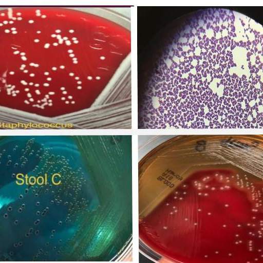 Microbiology quiz; plate reading app. 3.18.7z