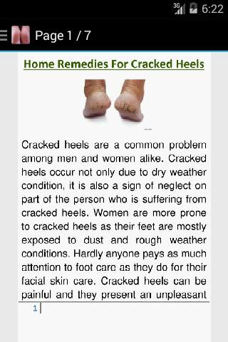 Get Rid of Cracked Heels screenshot 3