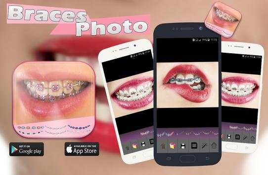 Braces Photo Booth screenshot 3