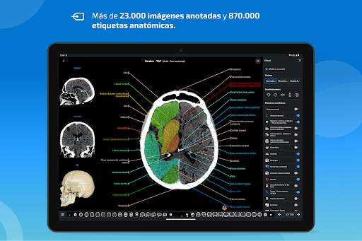 e-Anatomy screenshot 10