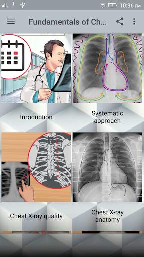Chest X-Ray Interpretation screenshot 1