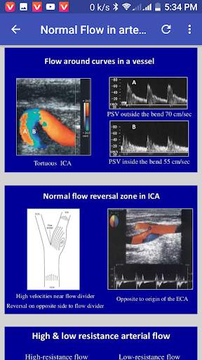 Doppler Ultrasound screenshot 2