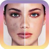 Cactus Photo Blemish editor 1.0.0