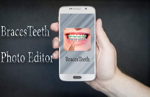 BracesTeeth Photo Editor screenshot 1
