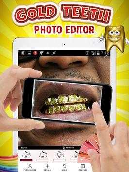 Gold Teeth Photo Editor screenshot 4