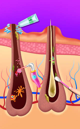 Makeup Artist - Pimple Salon screenshot 3