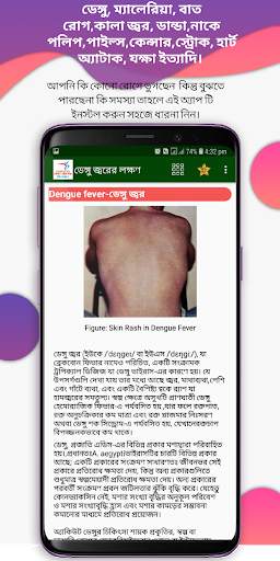 কোন রোগের কি লক্ষণ -Symptoms of Diseases screenshot 6