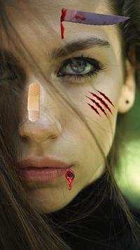 Injury Photo Editor screenshot 1