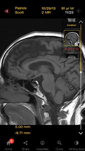 MEDX screenshot 5