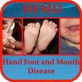 Hand Foot and Mouth Disease 1.0
