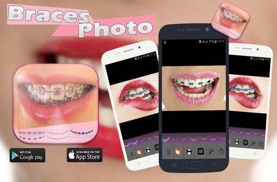 Braces Photo Booth screenshot 2