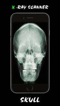 X - Ray Scanner screenshot 4
