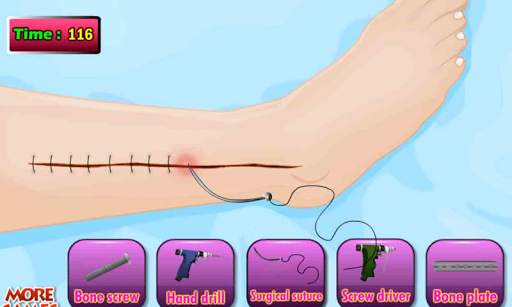 Doktor Tom Beinoperation Spiel screenshot 3