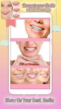 Decorate your Smile with Braces App screenshot 5