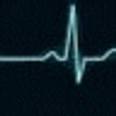 heartbeat 2.1.0.2