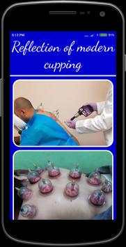 Cupping Therapy screenshot 7