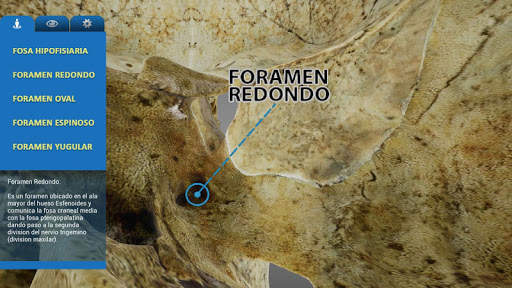 UC MedApp Craneo 3D screenshot 3