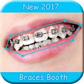 Braces on 9Apps