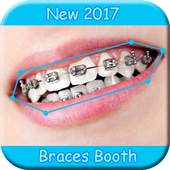 Braces 1.0