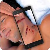 Bloody Wounds Photo PRANK 1.0