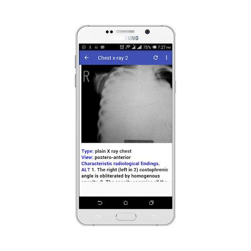 Chest X-ray Easy Learning screenshot 2