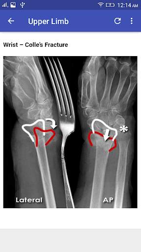 X-Ray Interpretation screenshot 8