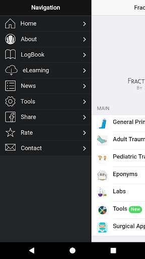 Fracture Classification (FC) screenshot 2