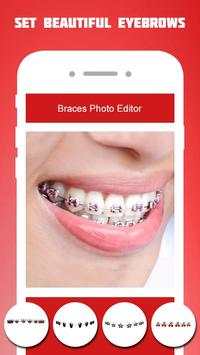 Braces Photo Editor 2018 screenshot 6