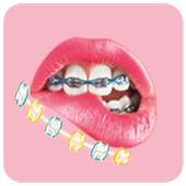 Braces Camera 2019 3.3