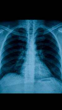 X-Ray Scanner screenshot 3