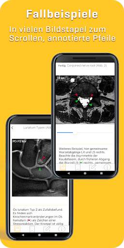 MRI Essentials screenshot 5