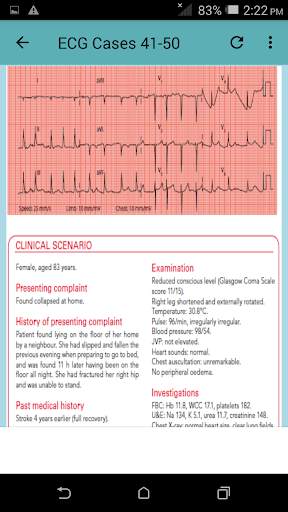 ECG Cases screenshot 2