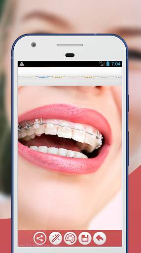 Braces Teeth Photo Editor screenshot 2