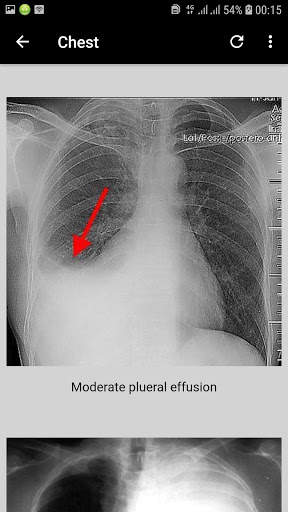x-ray interpretation guide screenshot 3