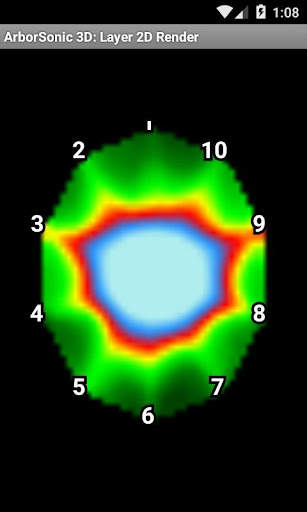 ArborSonic 3D for Android screenshot 2